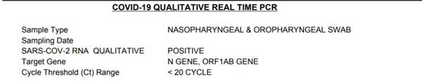 Fig-3: RT-PCR Corona test report